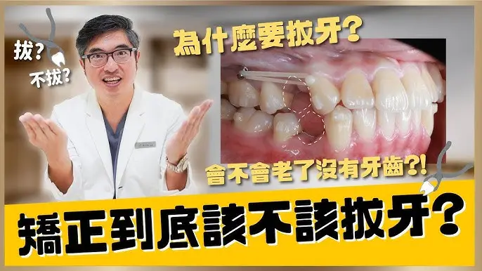 牙齿矫正到底需不需要拔智齿?牙齿矫正拔牙与不拔牙到底有什么优缺点?
